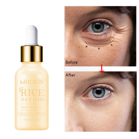 MUICIN - Rice Serum For Fairer & Flawless Skin - Even Tone Perfection