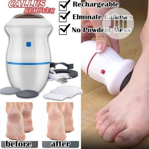 Home.Co- Callus Remover