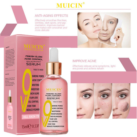 MUICIN - V9 Pinkish Glow Anti Acne Face Serum - Blemish-Free Radiance