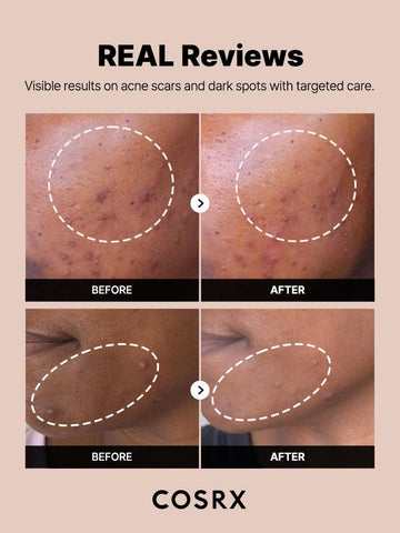 The Alpha-Arbutin 2 Discoloration Care Serum