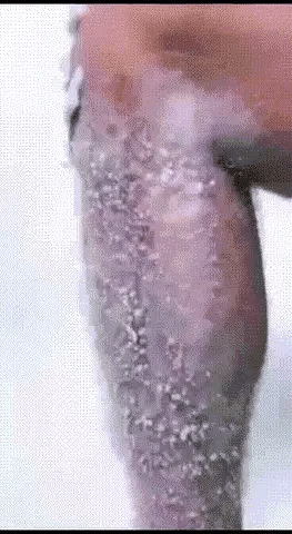 Ecrin Hair Removal Spray In 03 Minutes